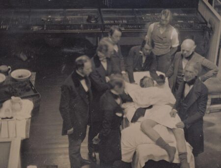 Early Operation Using Ether for Anesthesia, late spring 1847. A historical photograph capturing a medical operation in progress. The scene features a group of male doctors, dressed in formal attire with dark coats and bow ties, gathered around a patient lying on a table. The patient appears to be sedated and covered with a white sheet, with part of their leg exposed. The surrounding area includes medical tools and equipment indicative of the era. The image conveys the early days of surgical procedures and the evolution of medical practices.